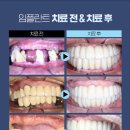 강남애프터치과 이미지