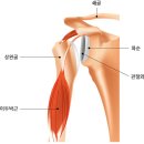 어깨관절와순파열[Shoulder labrum tear] 이미지
