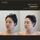 라즈뮤에스테틱