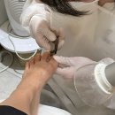 레푸스 종로점 : 종로 내성발톱 교정 후기 (김영주 부원장)