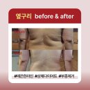 세인피부관리실 | “몸이 무겁고 붓는다면?” 림프순환 부터 [둔산동 세인 피부관리실]
