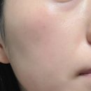 영기획 | 닥터지 레드 블레미쉬 크림 올영기획세트, 다시 써본 열감진정 수분크림 후기