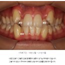 이탑치과 이미지