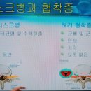 허리디스크와 척추협착층은 다르다? 이미지