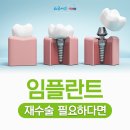 부산남천동치과 임플란트 재수술이 필요하다면