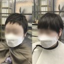 블랭크유 대전시청점 | 여자헤어증모술, 머리숱만 커버해 주고 끝? NO!