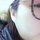 의료법인서원의료재단김형근예병원 | [나의 수술이야기] 알 수 없는 병명 볼거리? 침샘염?