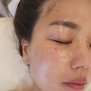 다산지금약국 | 다산피부관리 &#39;더마메디스킨케어&#39; 에서 기미주근깨 관리 후기