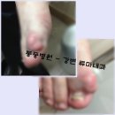 엄지맥주 이미지