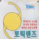 세란안과의원 티스토리
