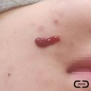 씨엘메디칼 이미지