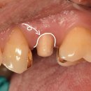 그리치과기공소 이미지