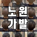 이태리가발 | 노원가발 찾는다면? 남여 탈모 유형별 가발 후기 보여드릴게요