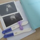 효인한의원 | 9주 계류유산 그리고 소파수술 (부천 초앤유여성병원)