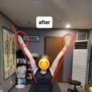 우암로R | 김해 체형교정 김해 통증관리 잘하는곳 정연체형관리 후기