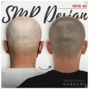마음에점을찍다 | 광주두피문신 마음에점을찍다 얇고 힘없는 머리 때문에 고민이라면