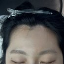 무드토탈뷰티 | 망포역 왁싱샵 무드왁싱&뷰티에서 헤어라인 왁싱 받은 후기✨ 영통왁싱·망포왁싱 추천