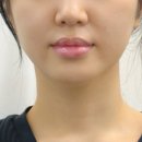 레하 필라테스&PT | 광화문 피부관리 후기｜페이스컨디셔닝 PT로 얼굴근육운동 리프팅 효과