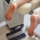 연수구 커낼워크 여름동 ~ 송도 라무진 앞 | 송도 발관리 | 발각질 심한 케이스 굳은살 제거 케어 후기 (+무좀) | 메디푸스