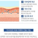 제노네일
