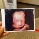 북구청소년회관 | 임신기록 16주 ~ 28주, 정밀 초음파, 임당 검사, 대구 신세계병원 태교 콘서트 후기