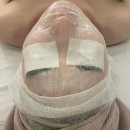 분당 정자 에스테틱 라스와브멘떼 여드름 관리 솔직후기 좁쌀여드름 관리