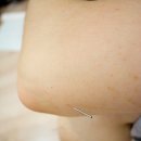 보경한의원 이미지