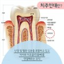 잎사귀치과병원 | [서울 서대문구]사랑니발치 휴기(feat.잎사귀치과병원) + 시간별 자세한 후기 + 주의사항 정리