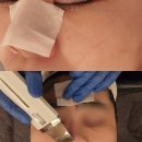 탈라코스메틱 | 구월동피부관리 탈라코스메틱에서 받은 수분폭탄 케어 후기