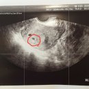 이현주산부인과의원 네이버블로그