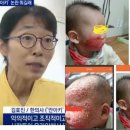 경희예인한의원 | 안아키 뜻 아나키스트 김효진 한의사 프로필 카페 화상온수요법 시민단체 카페고발 그것이알고싶다