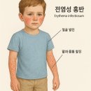 홍반