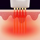써니케어 이미지