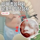 새봄한방병원 - 원주시 | 임신 26주차 증상 및 배크기ㅣ새봄여성병원 임당검사 & 입체초음파 후기