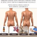 다리길이 차이 짝다리 안짱다리 오다리 교정 이미지