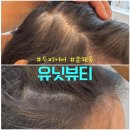 일산 숱채움 유닛뷰티 두피페인팅으로 입체감 살린 두피커버 2차 리터치