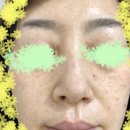 뷰티지아나 | 뷰티지아나 듀얼리즈 기미크림 색소침착 제거 후기