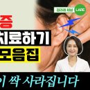 이명, 어지럼증 이렇게 드세요 이석증에 좋은 음식 외 귀 치료 모음집 이미지