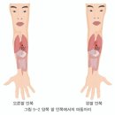 종부테라피 이미지