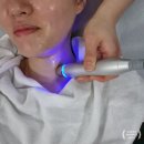 뷰티텐 거제 리프팅관리 미백 물방울 비립종 제거 솔직후기~!