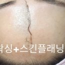 윤피부토탈관리 이미지