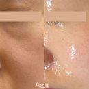 태초메디칼 | [공지] 강원도 원주 최대 규모 슈퍼젝션 전문센터 리하이가 알려주는 슈퍼젝션 완벽 가이드