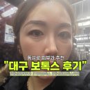 이마 | 동성로피부과 대구보톡스 추천, 이마 미간 사각턱 리얼후기