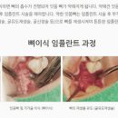 서울고운치과의원 이미지