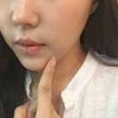 톡스미의원