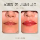 하루두피 광주첨단신창점 | 얇은 입술 반영구 문신 타투 오버립 후기 / 광주광역시 수완지구 첨단 자연스럽게 잘하는 곳