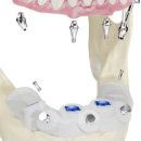 나비덴탈 이미지