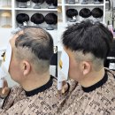 송정남자경로당 | 부산 송정 일광 남자맞춤가발 시술후기