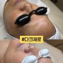 124 | [다크제로]“요즘 안색좋아졌네?” 피부톤 순삭, 김해피부관리 아우라에스테틱 토닝케어 후기