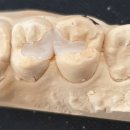 지안치과기공소 이미지